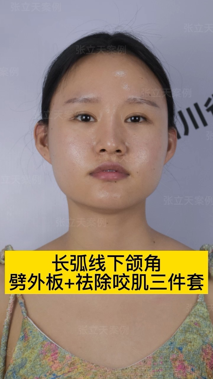 中正凹陷女人面相图解_男人眼睛凹陷面相图解_眉头上方凹陷面相图解