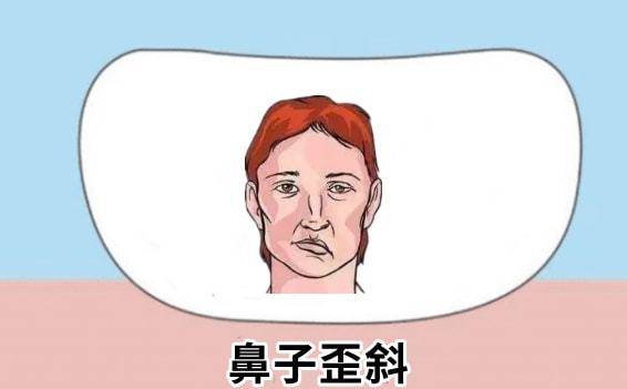 耳垂下方有痣图解面相_有耳垂好还是无耳垂好_女人嘴唇有痣面相图解