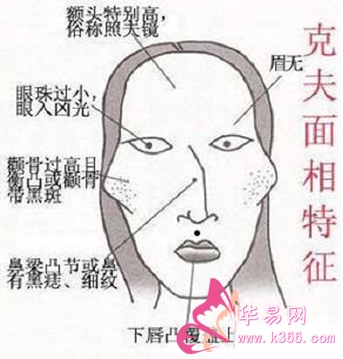 颧骨横突和颧插天仓区别_女人颧骨横突面相图解_颧骨横突面相图解