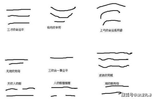 眉间皱眉是我们脸上一种正常的表情纹吗？